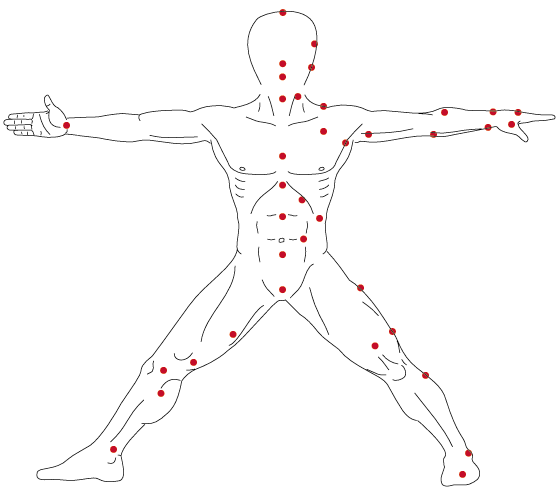 Vital Spots ©1999 Claudio Iedwab